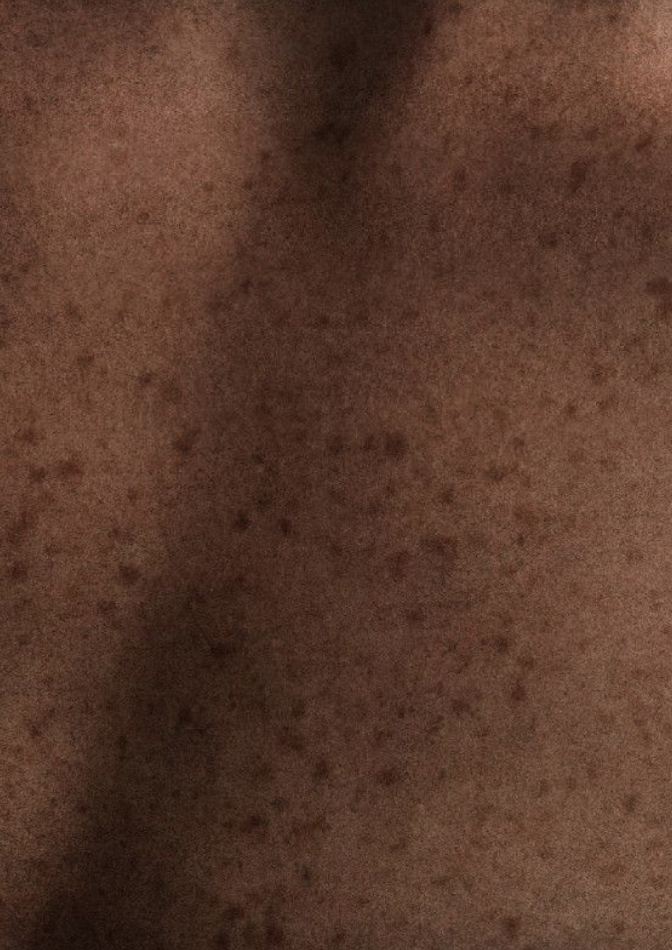 Skin scan